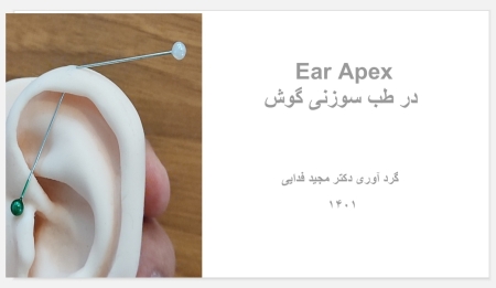 مروری کاربردی Ear Apex در طب سوزنی گوش