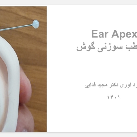 مروری کاربردی Ear Apex در طب سوزنی گوش