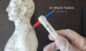 یافتن دادن نقطه ای طب سوزنی روی کتف